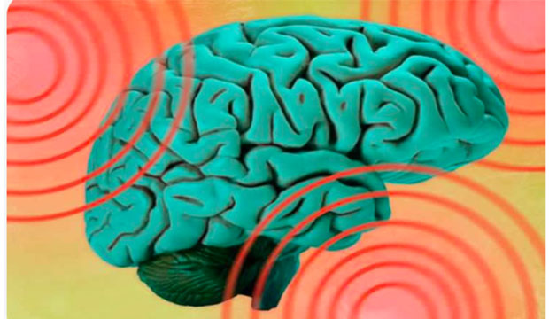 Brain being hit with energy waves.